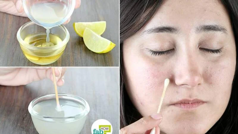 How to Use Lemon Juice for Dark Spots